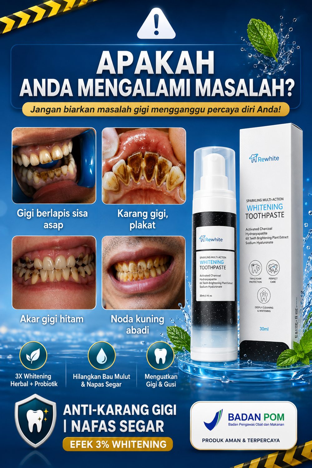 Apakah Anda mengalami masalah gigi berlapis sisa asap, karang gigi, akar gigi hitam, noda kuning